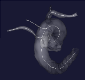 nonplanar_arch_top-1